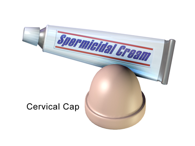 Cervical_Cap.png