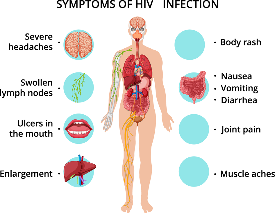 Symptoms Treatment And Prevention Of Aids — Lesson Science State