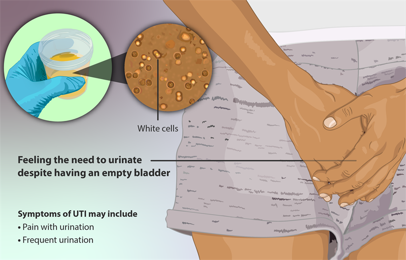 Urinary Tract Infections — lesson. Science State Board, Class 10.