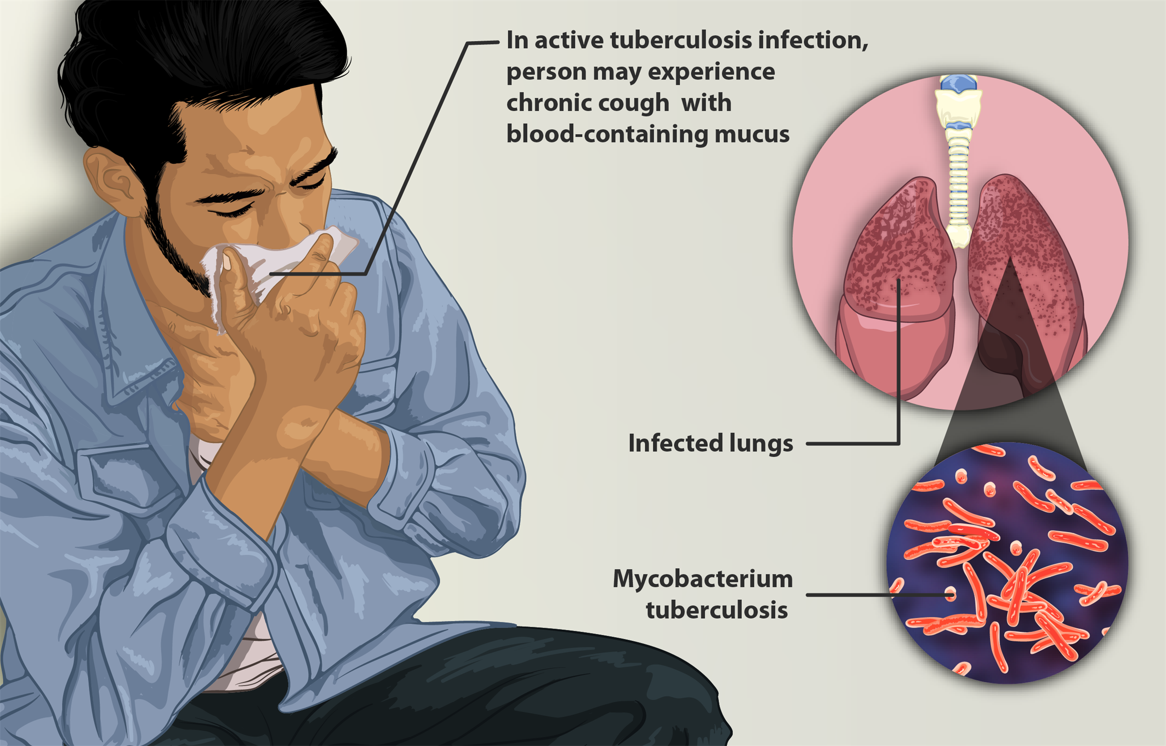 Health Risks And Tuberculosis — Lesson Science State Board Class 7