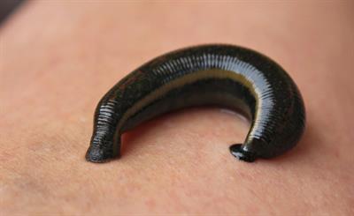 leech on hand.jpg