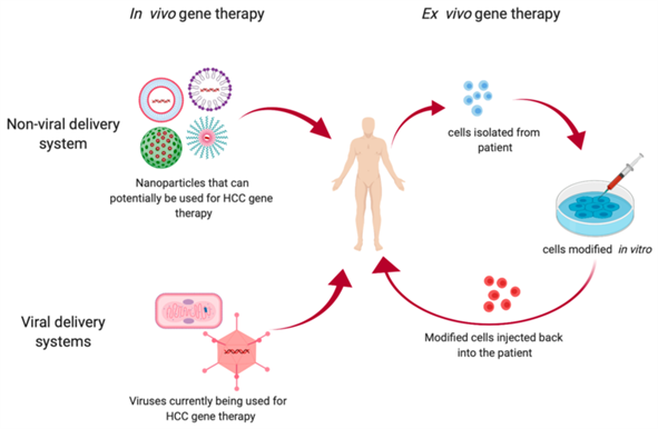 An_overview_of_the_types_of_gene_therapy_techniques_used_in_HCC_treatment.webp.png